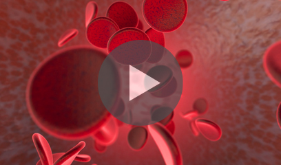 An educational video by Standing in the Gaap that shows an overview of multiple myeloma in African Americans for the general community